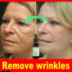 wrinkles disappear become beautiful now